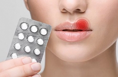 10 самых эффективных таблеток от герпеса